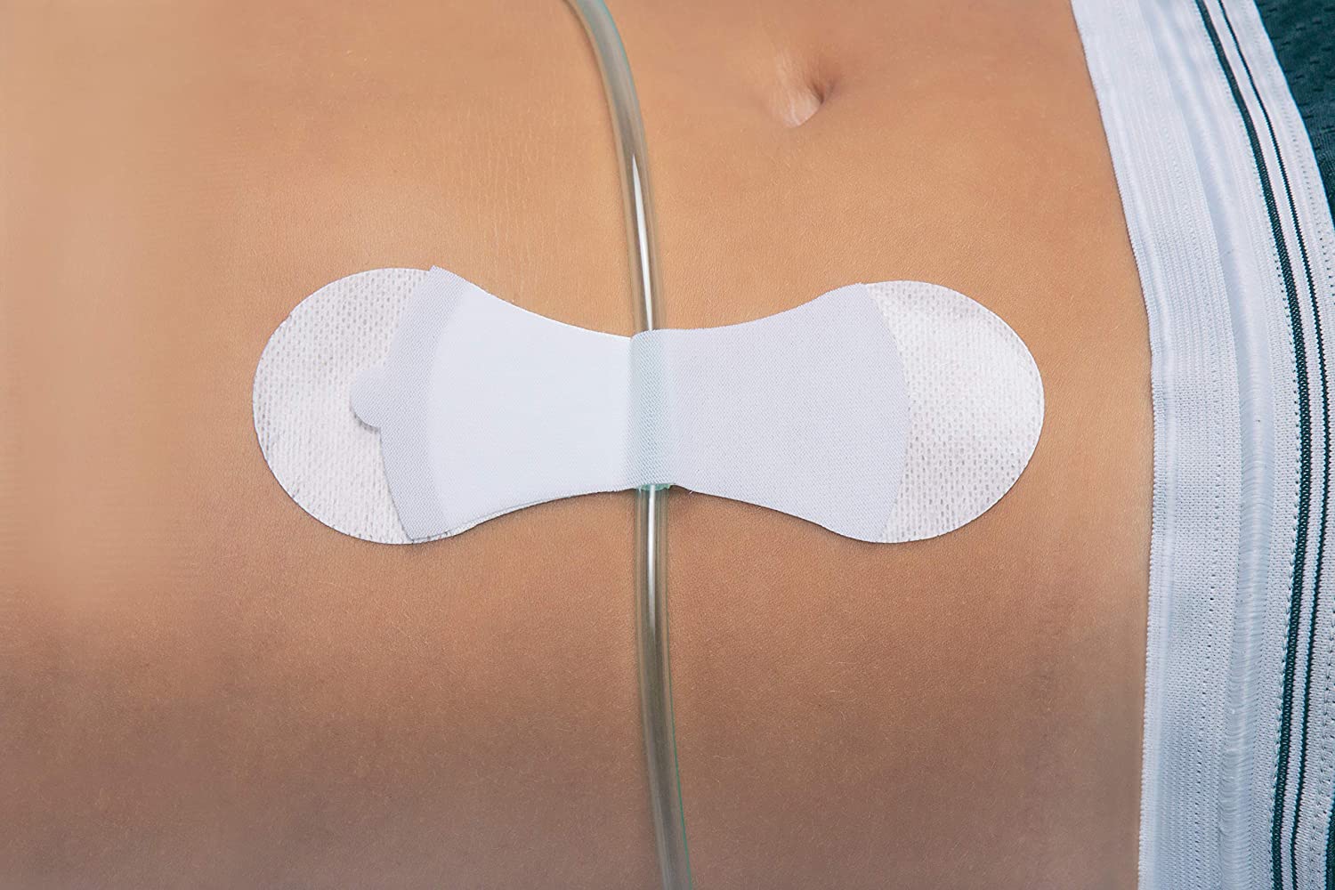 Grip-Lok® Securement Devices – Bowers Medical Supply